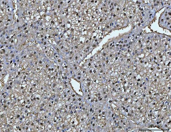  IHC analysis of FAA/FAH using anti-FAA/FAH antibody (A02072-1)