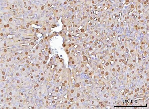 IHC analysis of FAA/FAH using anti-FAA/FAH antibody (A02072-1)