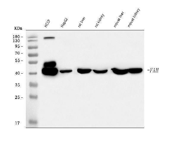  Western blot analysis of FAA/FAH using anti-FAA/FAH antibody (A02072-1)