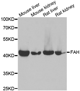 WesternBlot (WB) analysis of FAH polyclonal antibody