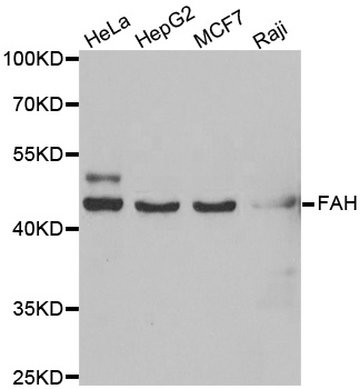 WesternBlot (WB) analysis of FAH polyclonal antibody