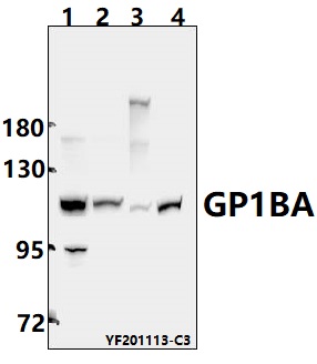 Western blot (WB) analysis of GP1BA pAb at 1:500 dilution
Lane1:Myla2059 whole cell lysate(40ug)
Lane2:SHSY5Y whole cell lysate(40ug) 
Lane3:SP2/0 whole cell lysate(40ug)
Lane4:C6 whole cell lysate(40ug)