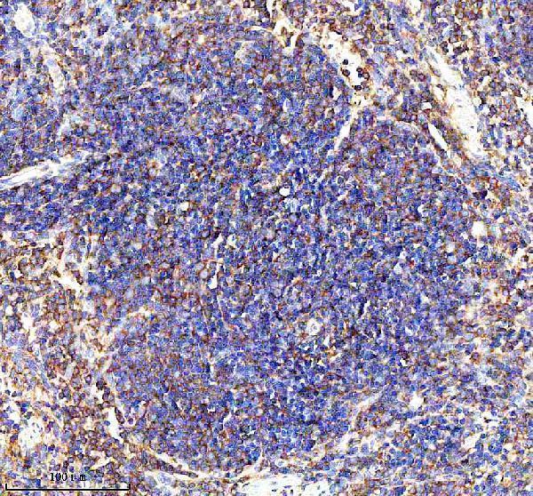  IHC analysis of CD42b/GP1BA using anti-CD42b/GP1BA antibody (A02073-4)