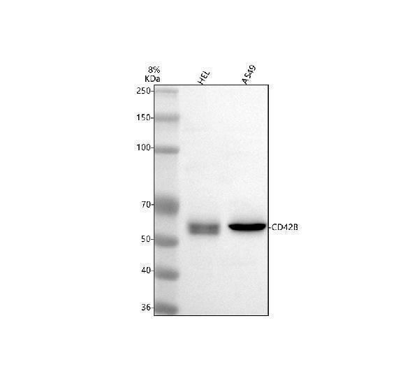 Western blot analysis of CD42b/GP1BA using anti-CD42b/GP1BA antibody (A02073-4)