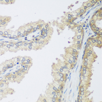 a02074 igfbp4 primary antiboties ihc testing 2