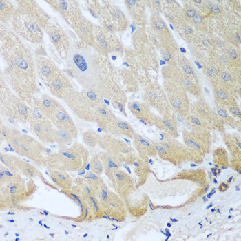 a02074 igfbp4 primary antiboties ihc testing 3
