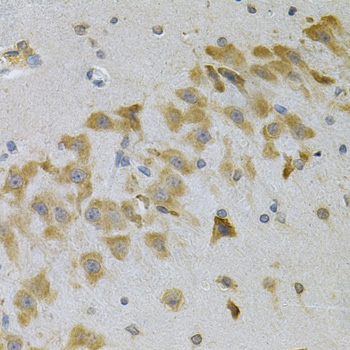 a02074 igfbp4 primary antiboties ihc testing 4