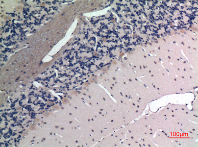 a02075 apln primary antibodyes ihc testing 2