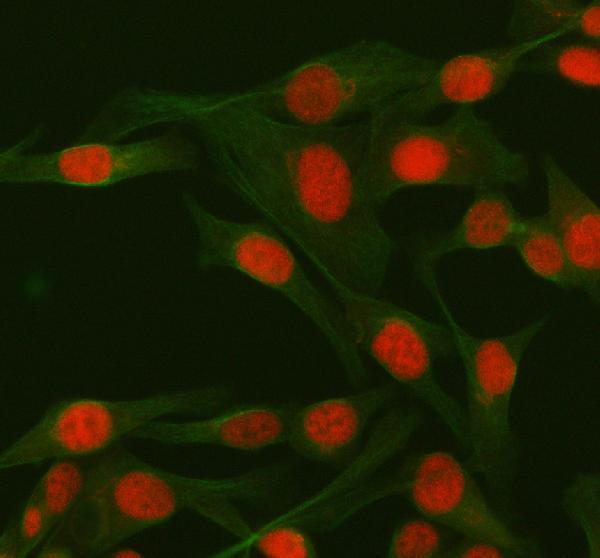 a02076 2 rbbp8 primary antibodies if testing 5