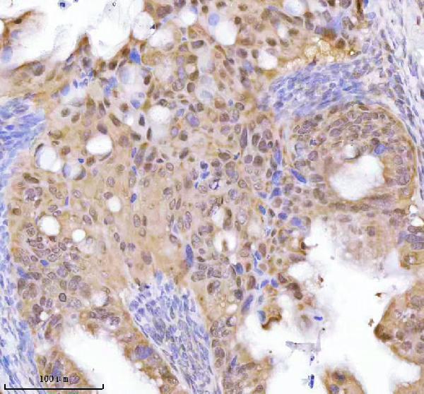 a02076 2 rbbp8 primary antibodies ihc testing 3