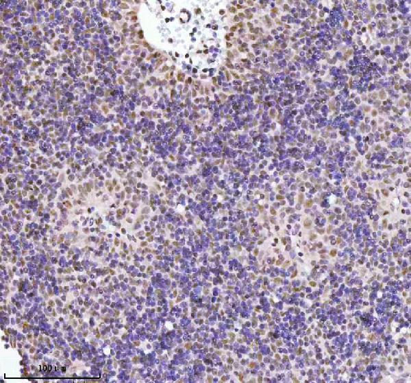 a02076 2 rbbp8 primary antibodies ihc testing 4