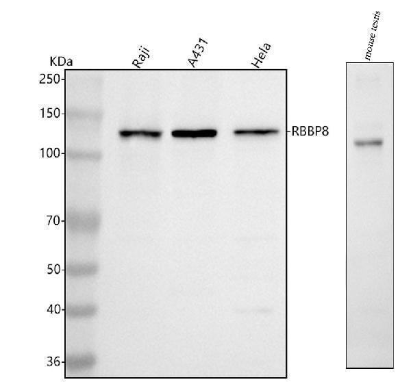 a02076 2 rbbp8 primary antibodies wb testing 1