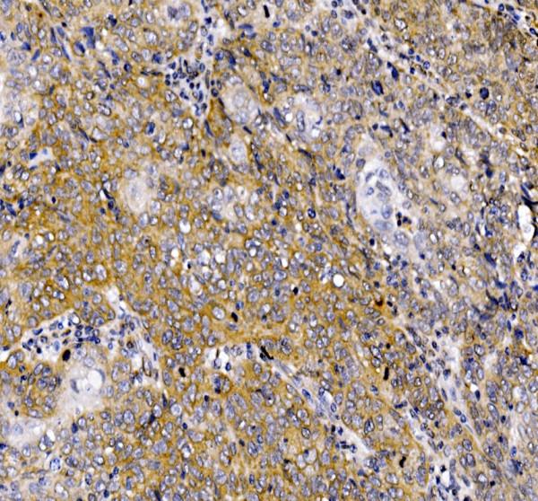 IHC analysis of PHEX using anti-PHEX antibody (A02078)