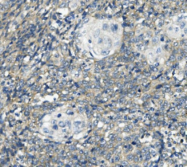  IHC analysis of PHEX using anti-PHEX antibody (A02078)