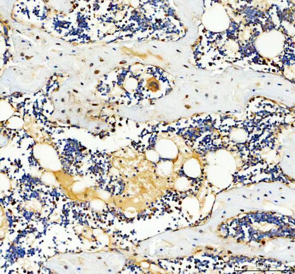 IHC analysis of PHEX using anti-PHEX antibody (A02078)