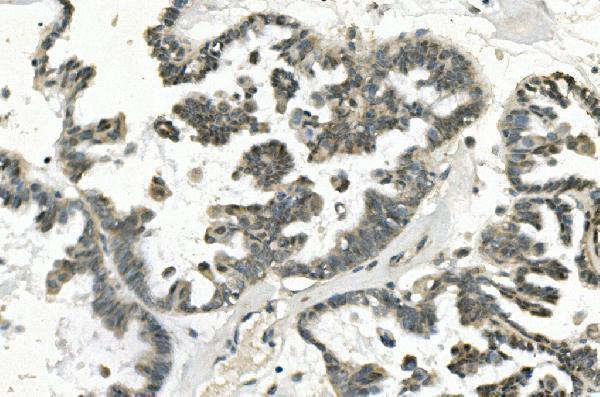  IHC analysis of PHEX using anti-PHEX antibody (A02078)