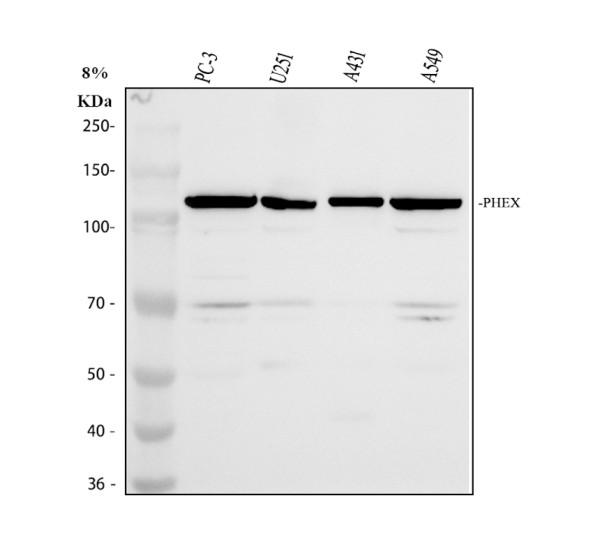 Western blot analysis of PHEX using anti-PHEX antibody (A02078)
