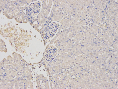 a02079 1 trim21 primary antiboties ihc testing 2
