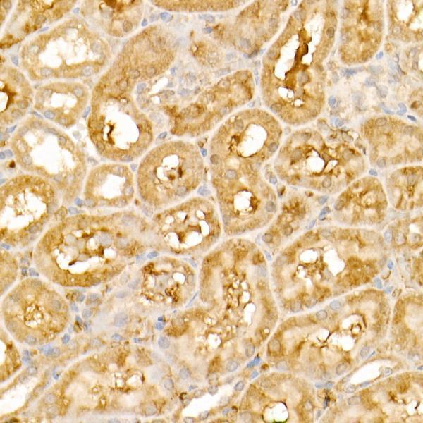 a02079 1 trim21 primary antiboties ihc testing 3
