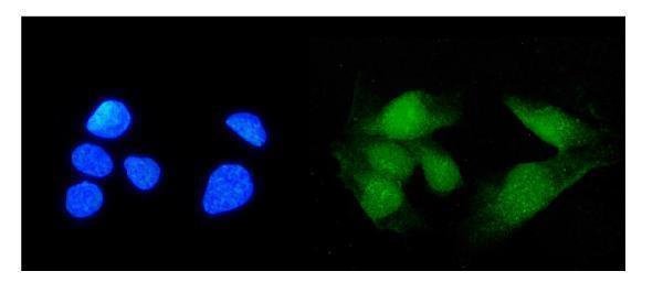  IF analysis of TRIM21/SS-A using anti-TRIM21/SS-A antibody (A02079-2)