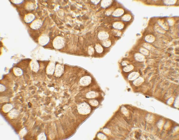 a02079 trim21 primary antibodies ihc testing 3