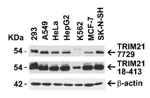 a02079 trim21 primary antibodies wb testing 2