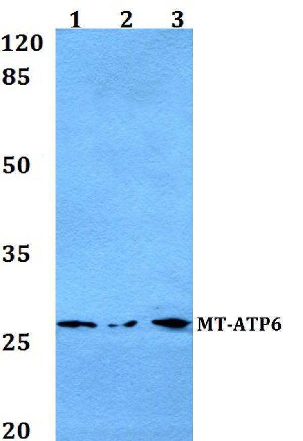 Western blot (WB) analysis of MT-ATP6 polyclonal antibody at 1:500 dilution
Lane1:Hela whole cell lysate
Lane2:A549 whole cell lysate
Lane3:PC12 whole cell lysate