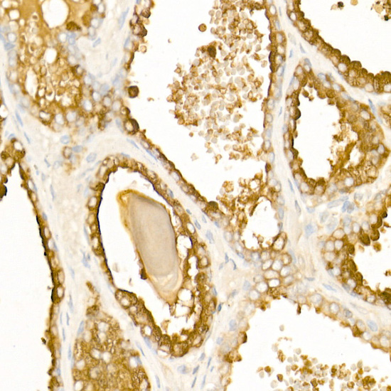 a02082 1 acpp primary antiboties ihc testing 2