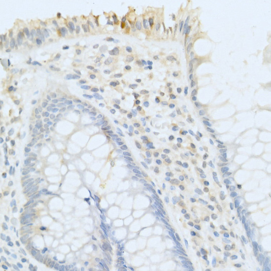 a02082 1 acpp primary antiboties ihc testing 3