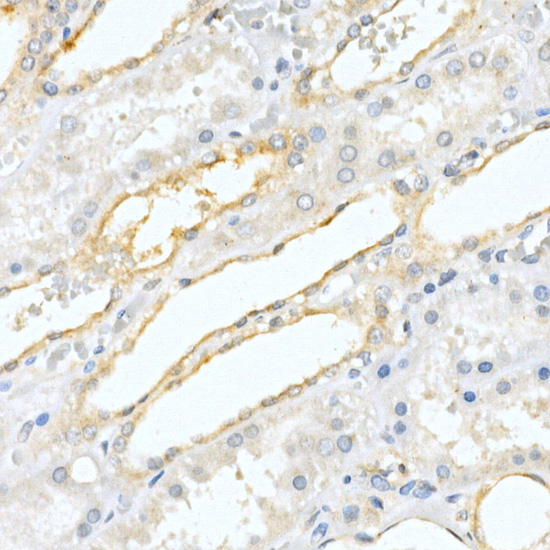 a02082 1 acpp primary antiboties ihc testing 4