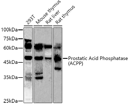a02082 1 acpp primary antiboties wb testing 1