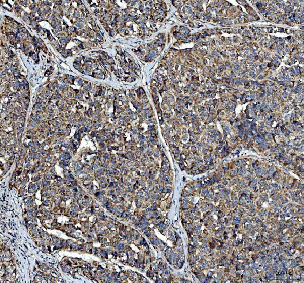 a02082 2 acp3 primary antibodies ihc testing 1