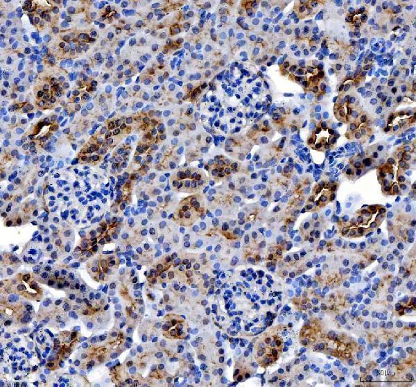 a02082 2 acp3 primary antibodies ihc testing 3