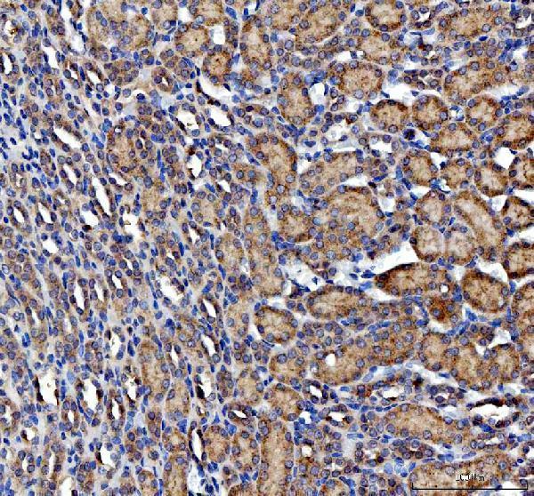 a02082 2 acp3 primary antibodies ihc testing 4