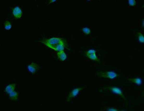 a02082 2 acpp primary antibodies if testing 5