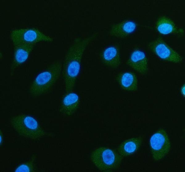  IF analysis of FABP5 using anti-FABP5 antibody (A02083)