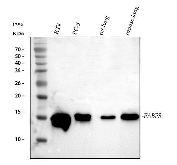  Western blot analysis of FABP5 using anti-FABP5 antibody (A02083)