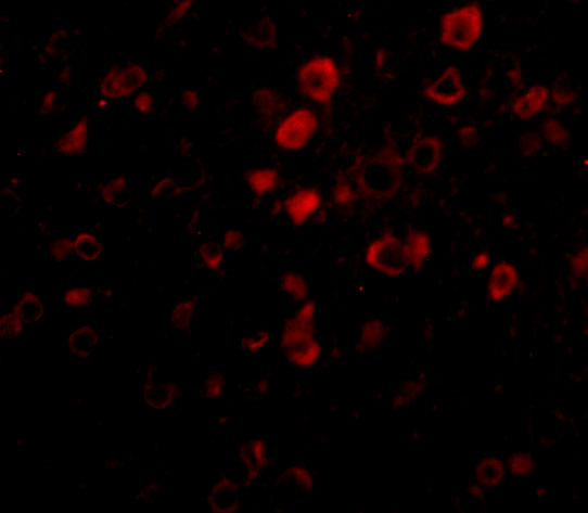 Immunofluorescence of Bora in Mouse Brain cells with Bora antibody at 20 μg/mL