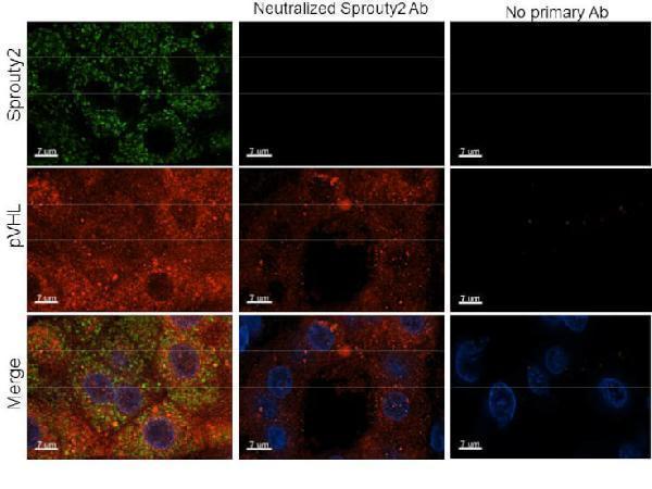 a02089 1 spry2 primary antibodies ihc testing 1_1