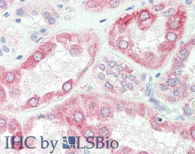 a02089 1 spry2 primary antibodies ihc testing 2_1