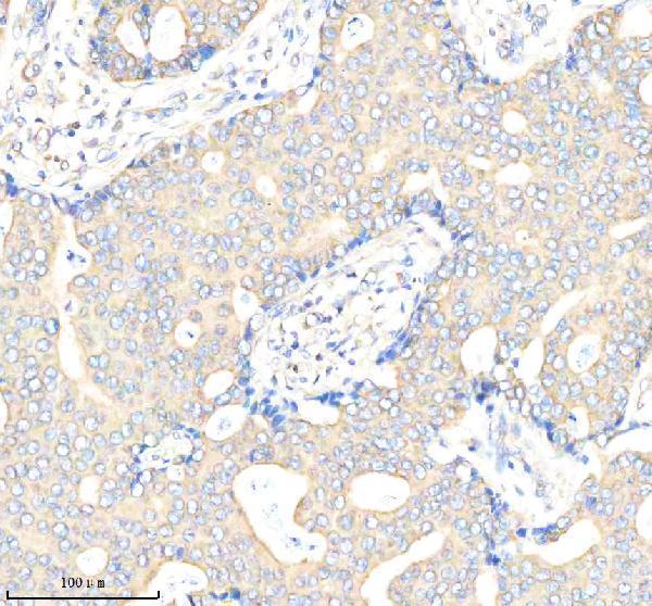  IHC analysis of Biglycan/BGN using anti-Biglycan/BGN antibody (A02090-2)