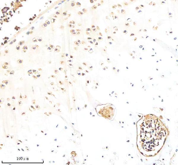  IHC analysis of Biglycan/BGN using anti-Biglycan/BGN antibody (A02090-2)