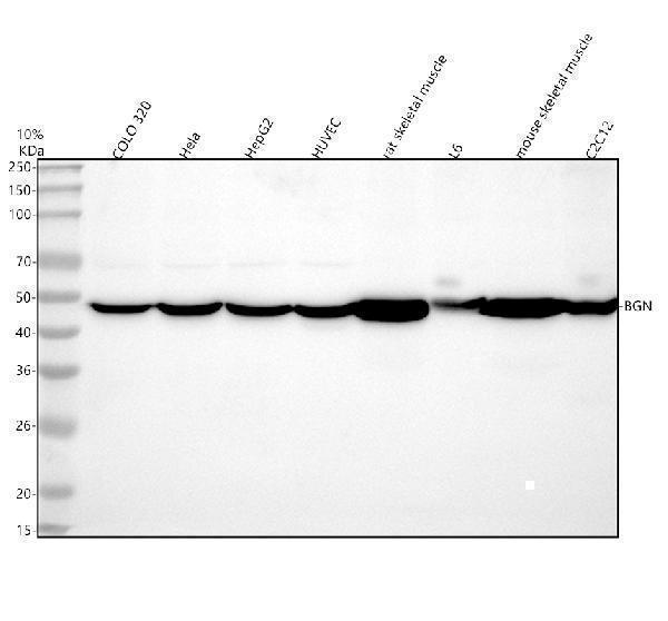  Western blot analysis of Biglycan/BGN using anti-Biglycan/BGN antibody (A02090-2)