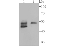 Western blot analysis of Biglycan on mouse heart and human skin tissue lysates using anti-Biglycan antibody at 1/500 dilution