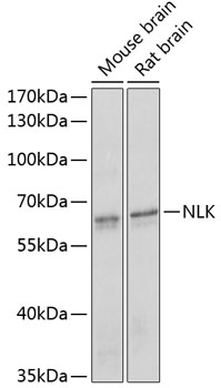 Western blot analysis of NLK polyclonal antibody