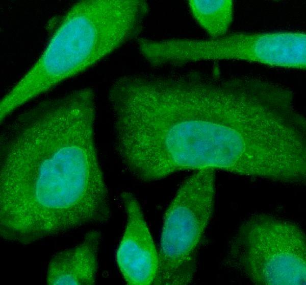 a02095 1 siah1 primary antibodies if testing 1