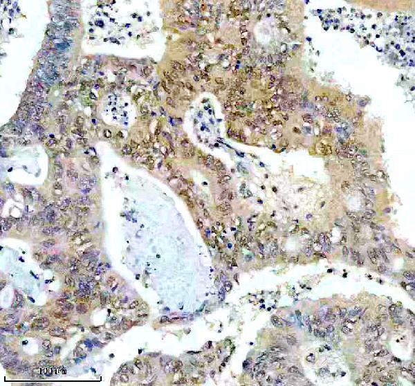 IHC analysis of SIAH1 using anti-SIAH1 antibody (A02095-1)