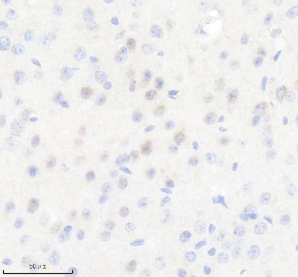 IHC analysis of SIAH1 using anti-SIAH1 antibody (A02095-1)