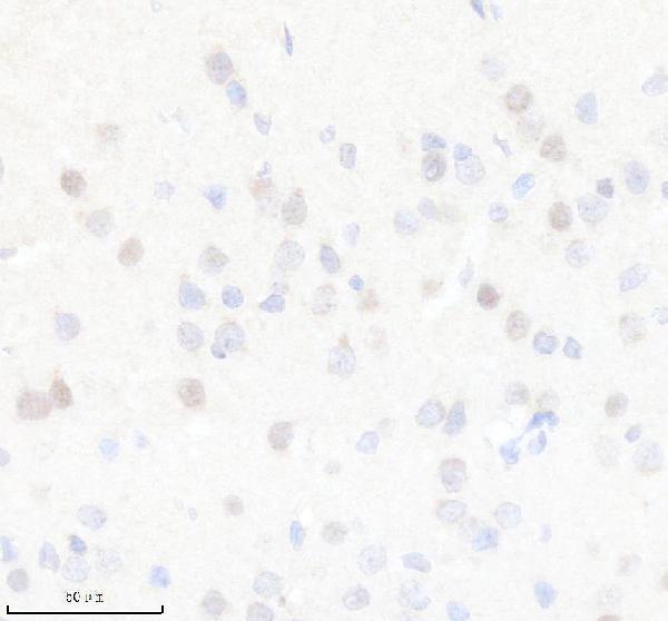 a02095 1 siah1 primary antibodies ihc testing 3
