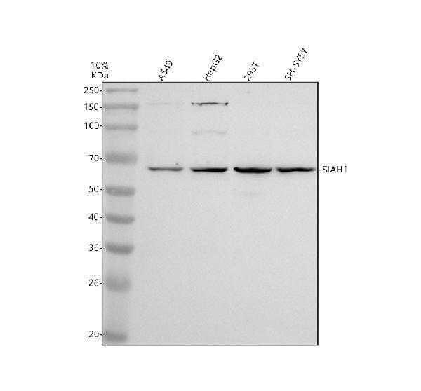 Western blot analysis of SIAH1 using anti-SIAH1 antibody (A02095-1)